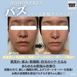 NONOKEKE ノノケケのエステ・リラクイメージ