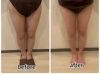 💎インディバ GEM💎indiba   healing room GEM所属・💎 GEM💎のエステ・リラクイメージ