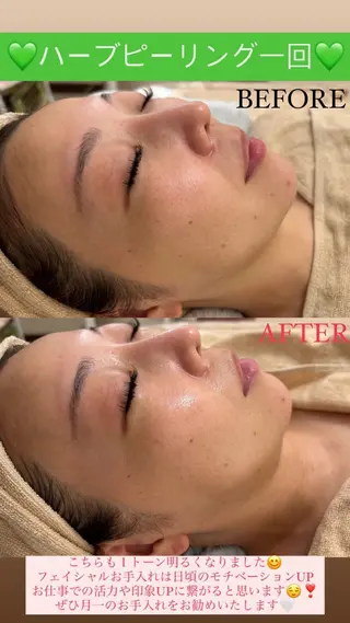 メンズ Salon de Lino 御器所のエステ・リラクイメージ