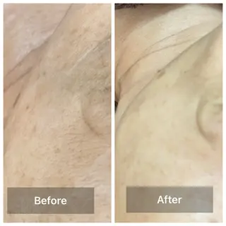 bonuru salonのエステ・リラクイメージ