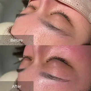 アイブロウ for woman所属・森 美優のエステ・リラクイメージ