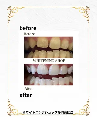 ホワイトニングショップ静岡葵区店所属・ホワイトニング ショップ葵区静岡駅店のその他イメージ