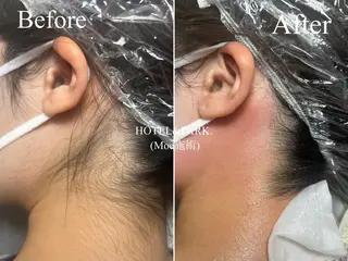 HOTEL&PARK . ワックス脱毛のエステ・リラクイメージ