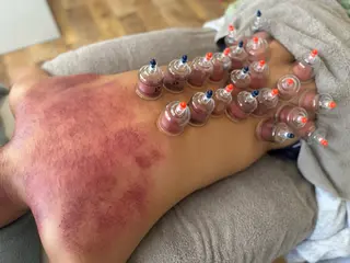 かっさ吸玉サロン Fluentのエステ・リラクイメージ