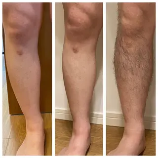 脱毛　マツ毛パーマ Moluのマツエク・マツパデザイン