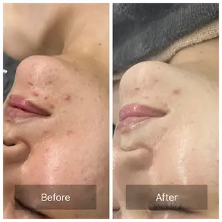 Iryアイリー所属・Iry アイリーのエステ・リラクイメージ