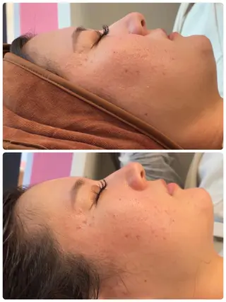 FLEUR🫧 フェイシャルのエステ・リラクイメージ