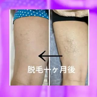 脱毛＆リラクエステA＊所属・脱毛&リラクエステ A*（アスター）のエステ・リラクイメージ