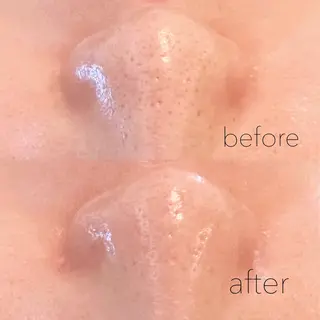 眉毛×肌質改善🫧 高岳/新栄町✨YUUの眉毛・アイブロウイメージ