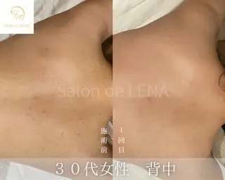 ハーブピーリング・毛穴ケア専門サロンSalon de LENA 栄店所属・ハーブピーリング専門 サロンドレナ　白藤のエステ・リラクイメージ