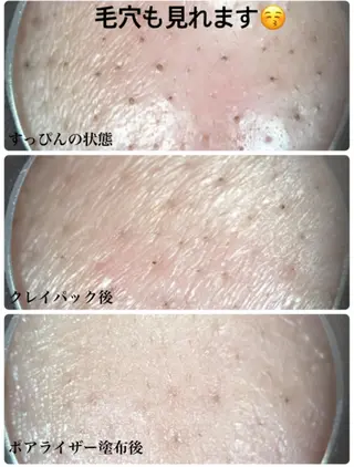 フェイシャルサロン 熱田のエステ・リラクイメージ