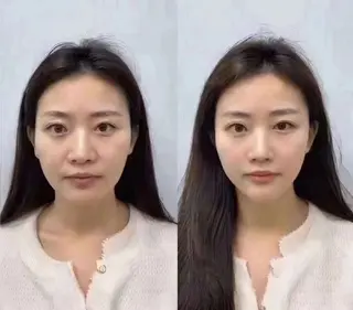 ネイル aliaハイフ&水光ジェットサロン所属・aliaハーブ水光店 エステティシャン募集のエステ・リラクイメージ