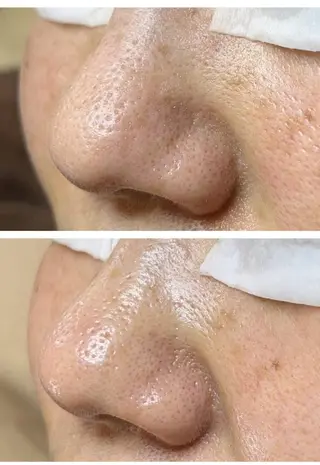 Lipula リプラ所属・毛穴ツヤ肌専門    Lipulaのエステ・リラクイメージ