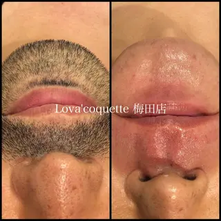 メンズ ラヴァコケット 梅田店のエステ・リラクイメージ