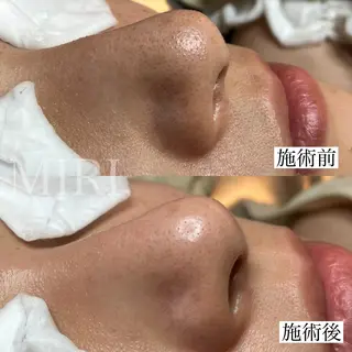 MIRI所属・北堀江/毛穴改善専門 ミリのエステ・リラクイメージ