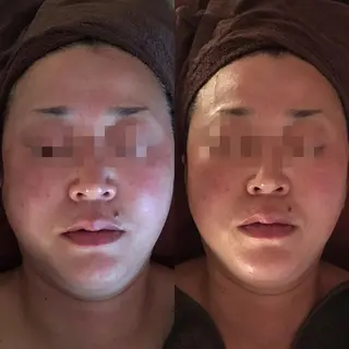 脱毛サロン avenirのエステ・リラクイメージ