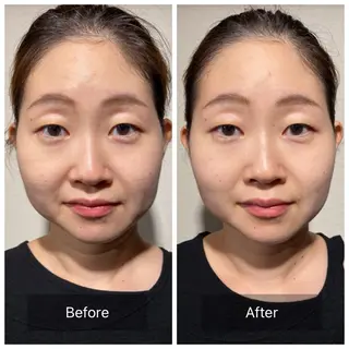 そとやまのはり おきゅう所属・外山 勝敏のエステ・リラクイメージ