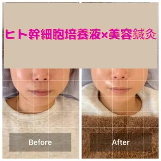 gomi sayakaのエステ・リラクイメージ