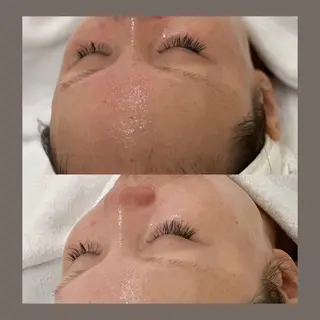 愛維美水光美肌専門店所属・愛維美水光美肌専門店 メンズレディースokのエステ・リラクイメージ