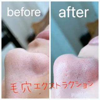 Rifuro毛穴ケア &よもぎ蒸しサロンのエステ・リラクイメージ