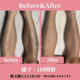 メンズ 有人型セルフサロン 脱毛/痩身/美顔のその他イメージ