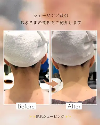 GOTODAY  SHAiRE SALON VITA店所属・艶肌シェービング✨ 小山/原宿のエステ・リラクイメージ