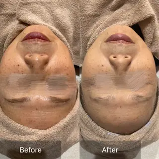 和漢よもぎ蒸しとフェイシャルのお店 maison de beaute所属・よもぎ蒸し/ 大人ニキビ mamiのエステ・リラクイメージ