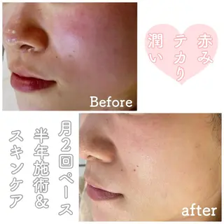 ショート カラー パーマ ヘアアレンジ メンズ キッズ ネイル マツエク・マツパ ニキビ&跡改善サロン オーナー光木のエステ・リラクイメージ