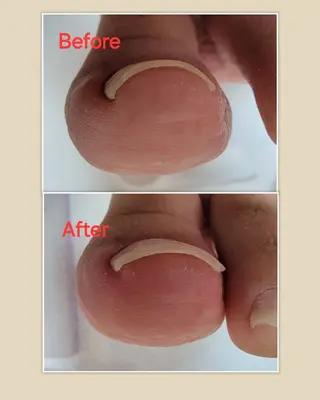 ネイル&巻き爪サロン 　AKnailのネイルデザイン