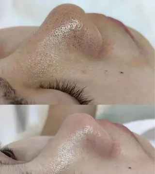 ネイル aliaハイフ&水光ジェットサロン所属・aliaハーブ水光店 エステティシャン募集のエステ・リラクイメージ