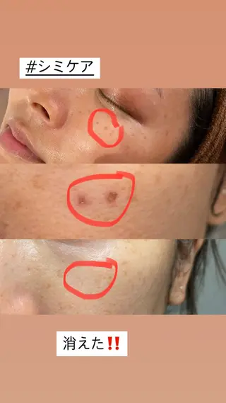 Meetite 小林のエステ・リラクイメージ