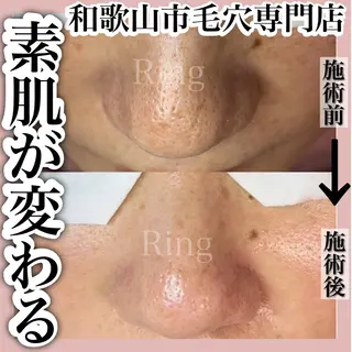和歌山　毛穴専門店 Ringのエステ・リラクイメージ