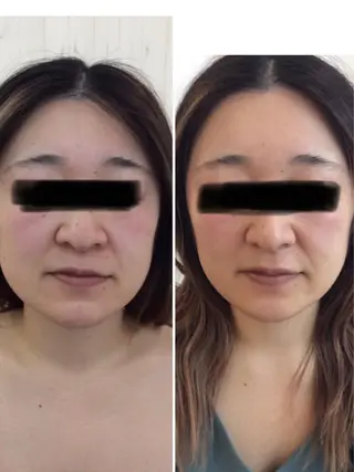 アールビューティーバランス所属・アール hirokoのエステ・リラクイメージ