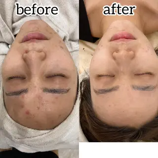 laluna saki...のその他イメージ