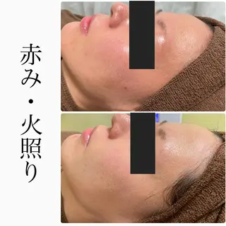 ハーブピーリング専門 BIOEL横浜のエステ・リラクイメージ