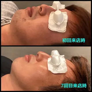 メンズ メンズ脱毛ECXIA所属・men's脱毛サロン ECXIAのエステ・リラクイメージ