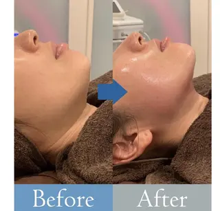 Crescent Beautyのエステ・リラクイメージ