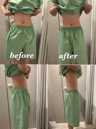 メンズ 腸活サポート みなみののエステ・リラクイメージ