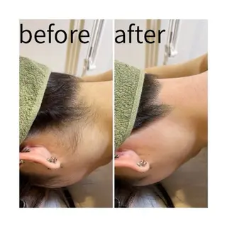 キッズ ブラジリアンワックス＋光脱毛専門店námir【ナミル】所属・ブラジリアンワックス ＆光脱毛námirのエステ・リラクイメージ