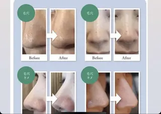 ハーブ🌿小顔❤ 海老名💎大西玲子のエステ・リラクイメージ