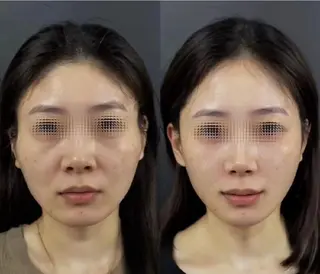 マツエク・マツパ aliaハイフ&水光ジェットサロン所属・aliaハーブ水光店 エステティシャン募集のエステ・リラクイメージ