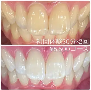 メンズ ホワイトニングルーム　川崎店所属・ホワイトニング ルーム　川崎店のその他イメージ