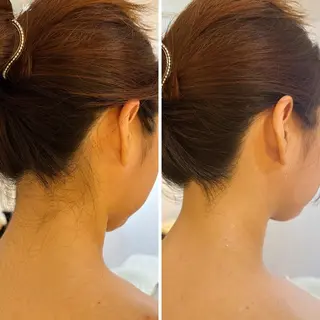 うなじ脱毛/美肌脱毛 LABELのエステ・リラクイメージ