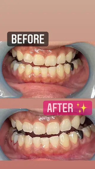 LAVISH nail salonのネイルデザイン