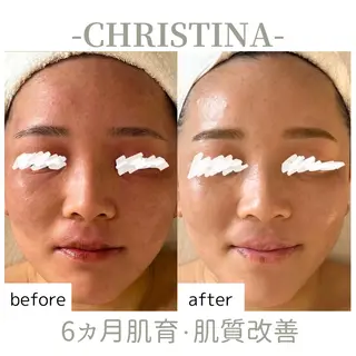 肌質改善|天王寺 For...はるかのエステ・リラクイメージ