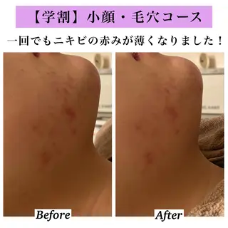 Bellesthe （ベルエステ）のエステ・リラクイメージ