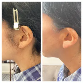 meow by hug.所属・恵比寿🌻ワックス 顔うなじVIOワキのエステ・リラクイメージ