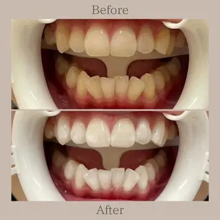 ホワイトニングサロン SARAのエステ・リラクイメージ