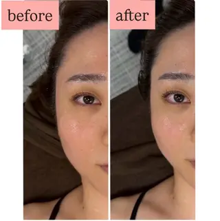 MIRAI小顔 岡山店のエステ・リラクイメージ