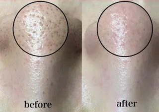 マツエク・マツパ 韓国肌管理 【毛穴専科】のエステ・リラクイメージ